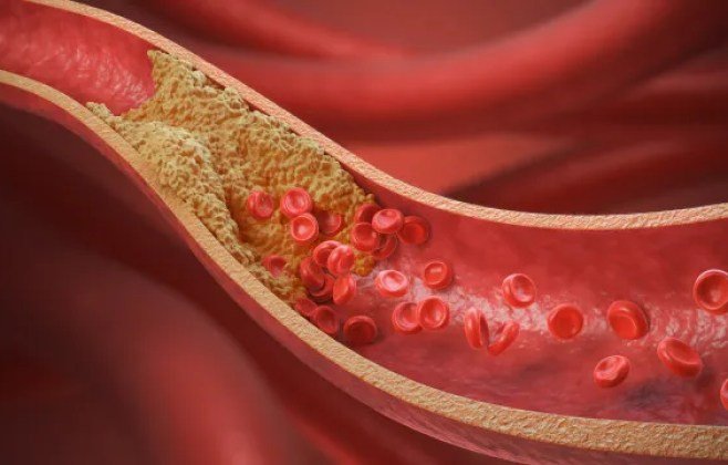 10 alimentos recomendados por cardiologistas para baixar colesterol