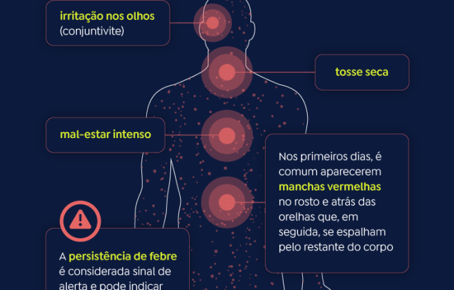 Sarampo em Alagoas: Sintomas, Riscos e Vacinação