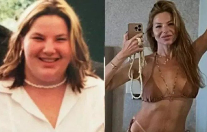 Repórter da Globo perde 70 kg após cirurgia bariátrica e desabafa