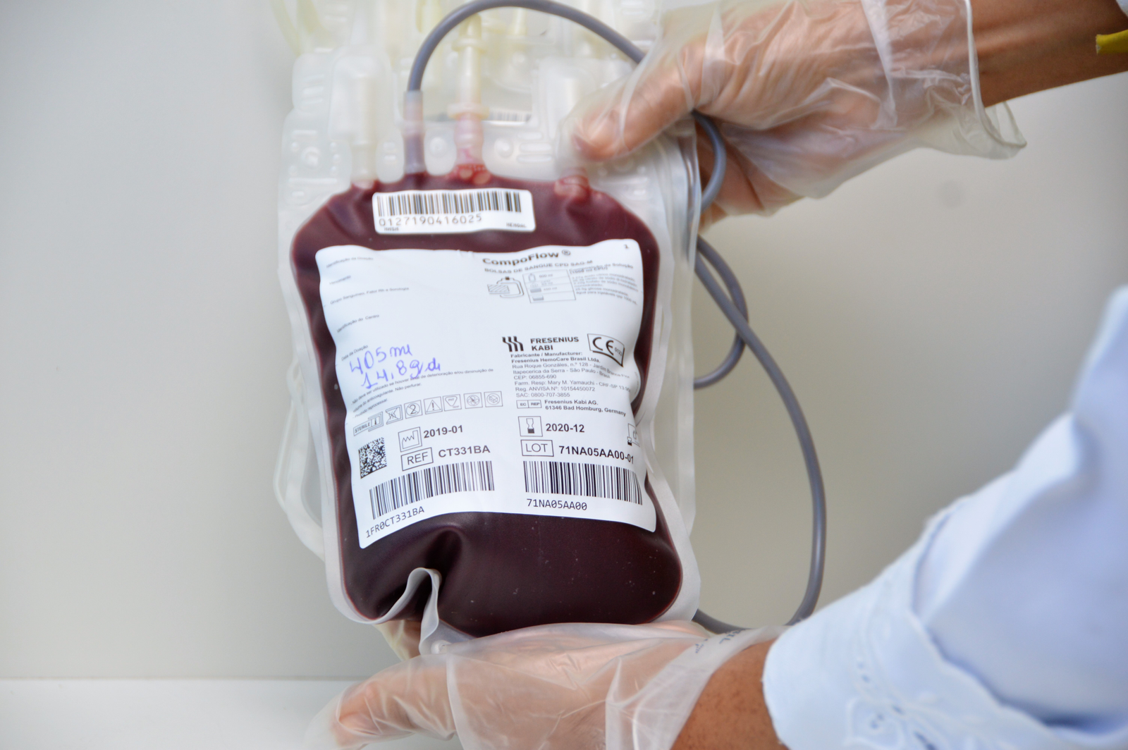 UTILIDADE PÚBLICA – Hemoal promove coleta de sangue e cadastro para doação de medula óssea na Uninassau Maceió UTILIDADE PÚBLICA – Hemoal promove coleta de sangue e cadastro para doação de medula óssea na Uninassau Maceió