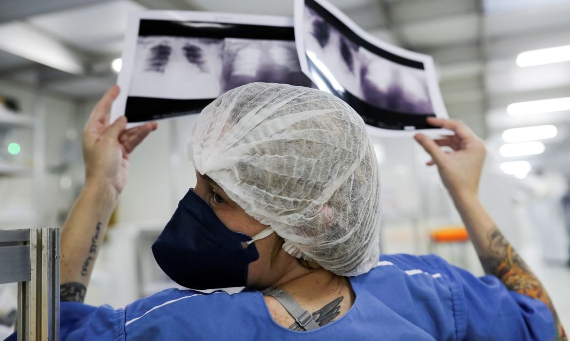Câncer de pulmão: Diagnóstico tardio afeta chances de cura